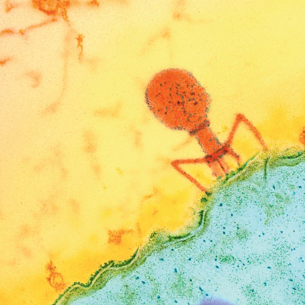 This is a a bacteriophage.