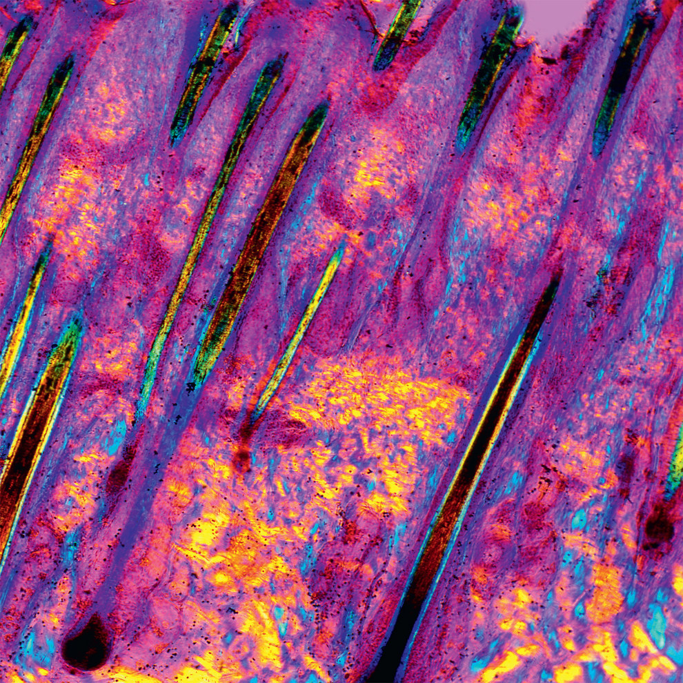 This is what human skin really looks like up close.